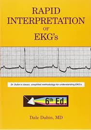 Rapid Interpretation Of Ekg S Sixth Edition Dubin Dale 9780912912066 Amazon Com Books