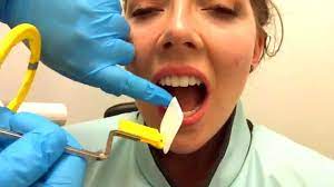 See full list on rdhmag.com How To Take Periapical Radiographs Youtube
