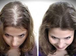 Sac Gurlestirme Yontemleri Sac Sac Bakimi Dogal Sac