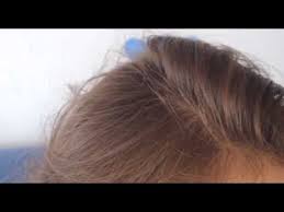 Les gommages capillaires existent dans le commerce depuis longtemps. 76 Faire Un Gommage Du Cuir Chevelu Youtube