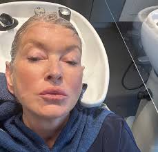 Christie Brinkley Reveals Her Cosmetic Procedures