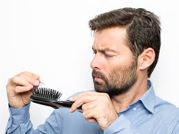 How long does the redness last after a hair transplant? How Long Will An Fue Hair Transplant Last Toronto Hair Transpalnt Clinic