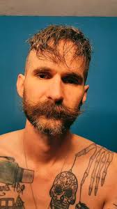 Young Guys with Partial Dentures