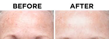 Red Light Therapy For The Skin Light Therapy Red Light Therapy Skin Makeup