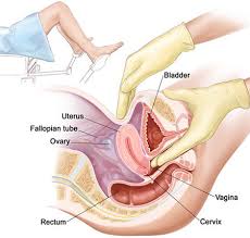 Gyno, closeup, japanese dildo, japanese peeing, japanese gyno, asian gyno. Annual Ob Gyn Exam Gynecology Test In Midtown Manhattan Ues