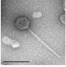 The viruses make a 'decision' when they infect a cell as to whether or not this is a good time to lyse the so now, long after they began to understand how worthwhile the lambda virus was to study. Transmission Electron Micrograph Of Psychrobacter Phage Psymv2 Phages Download Scientific Diagram