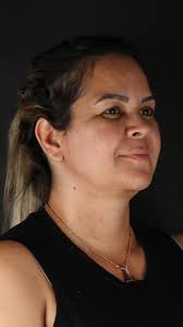 Vai além de um procedimento!, É a realização de um sonho para muitas🌷✨, Se  você busca um resultado incrível, uma aparência natural e harmoniosa, essa  é sua oportunidade! 🥰, 📍Rua Inácio Franco Alves, ...