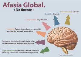 We did not find results for: Afasia Global Neurolinguistica Unap