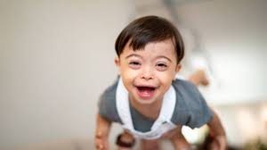 Características de los niños con sindrome de down. Dia Mundial Del Sindrome De Down 21 Cosas Sobre Esta Afeccion