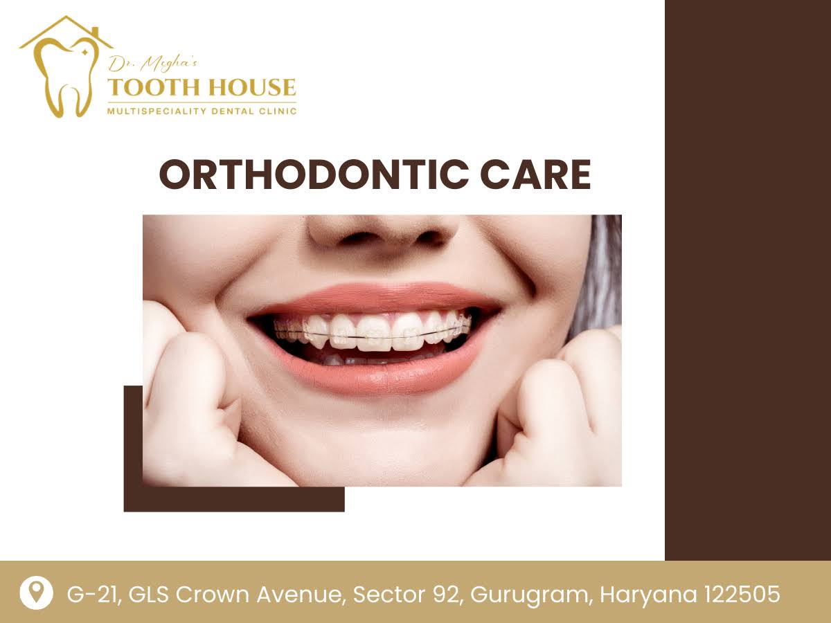 Ceramic Braces product image
