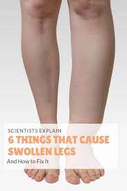 Pin On Healthy Living