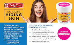 Alergia a patata (23 min), quality: Amazon Com De La Cruz Sulfur Acne Treatment Maximum Strength And Water Washable To Clear Face And Body Acne For Adults And Teens 2 6 Oz Health Personal Care
