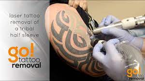 These larger tattoos are an investment and typically something a person will want on their body permanently. Laser Tattoo Removal Of A Tribal Half Sleeve Youtube