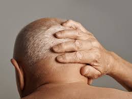 Image result for Acute Localized Headache