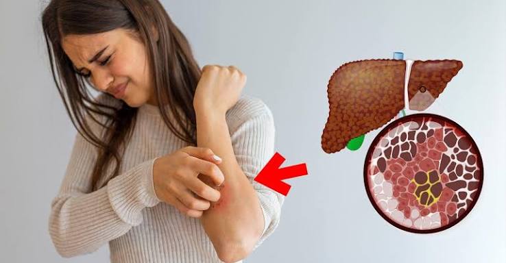 Biểu hiện của bệnh gan như thế nào? Cách kiểm tra gan tại nhà - Bệnh viện FV