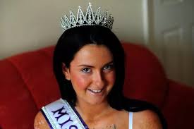 Burns victim Erin McNeil launches £1m compensation claim against friend who  tried to save her from blaze