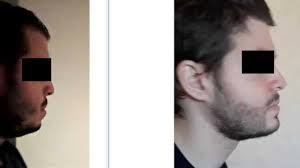 Nearly three years ago, on april 23, 2018, a man in his 20s drove a rented van down a crowded toronto street, jumping the curb, killing 10 people. Incels Auf Lookism Net Beleidigen Manner Sich Gegenseitig Fur Ihr Aussehen