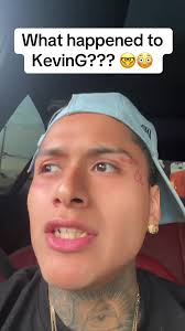 Why Can Kevin G Not Walk