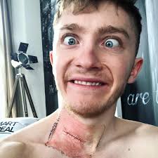 3 years today since the biggest challenge I've faced.. Not only did my neck  break , my life broke with it! I was deeply depressed, an addict &  eventually as you know