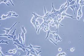 enzalutamide after docetaxel and abiraterone acetate treatment in prostate cancer: Study Results For Enzalutamide In Prostate Cancer Published