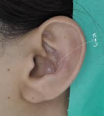 宇都宮ひふ科形成外科