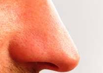 Test Ist Meine Nase Gebrochen