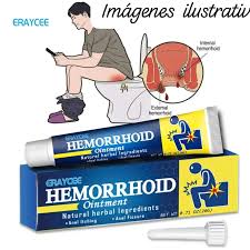 NUEVO ✔️UNGÜENTO PARA HEMORROIDES TSUNAMI ✔️Precio único ₡1500 cada unidad  👉BENEFICIO..para la salud este producto se utiliza para beneficio para la  salud dela hemorroides internas y externas hemorroides mixtas ,sangrado  fecal prolapso