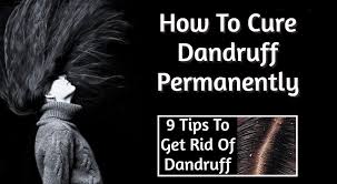 These flakes makes the skin to feel itchy and dry. How To Cure Dandruff Permanently Read These 9 Tips