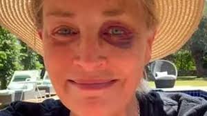 Sharon Stone verrät, was hinter ihrem blauen Auge steckt