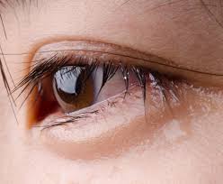 Looking At Tears Under A Microscope Reveals A Shocking Fact Shocking Facts Things Under A Microscope Tears