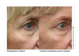 Um dem wunsch der nachhaltigkeit nachzukommen, richtete man eine pelletheizung mit unterirdischem. Dr Med Marenholz Asthetische Dermatologie