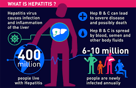 Image result for hepatitis