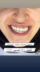 Dr Mahdi Hajj Ali (@drmahdihajjali) · Nabatîyé