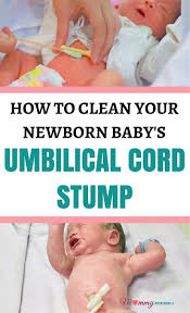 Umbilical cord stump infections are not uncommon. How To Care For A Newborn Baby Umbilical Cord Newborn Baby