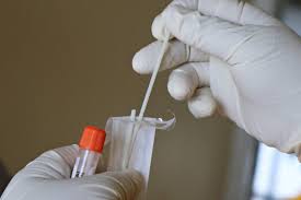 Il sera demandé un test pcr négatif à tous les voyageurs européens qui entrent en france à compter de dimanche. Coronavirus The Time Period To Get A Pcr Test Decreases Sortiraparis Com