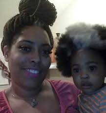 Baby's White Hair Streak Is Actually a Rare Inherited Genetic Condition