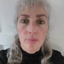 Knee pain concerns after replacement surgery