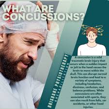 Image result for Concussion