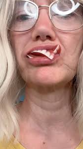 Part 2 of silicone denture review #siliconedentures #diydentures