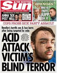 Scotland's papers: Party 'acid' attack probe