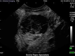 Image result for corpus luteum sonography)