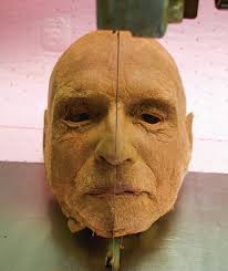 Anatomy of the Eyelid, Orbit, and Lacrimal System