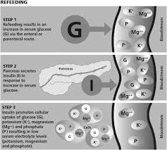Image result for Refeeding Syndrome