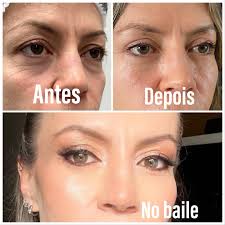 Amo quando a paciente linda, manda pra mim a foto assim, mais linda  ainda!❤️❤️❤️ Hoje recebi uma mensagem dessa paciente querida , com uma foto  linda depois da maquiagem para um casamento .