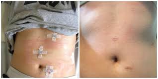 This does not mean that the patient won't be able to eat normal food. Pin On Liquid Soft Diet Ideas