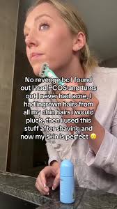 Shaving Down Sides of Chin