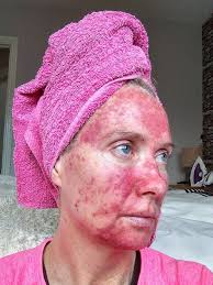 Pin On Dermatology From A To Z