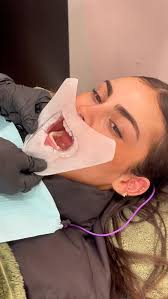 SMILE LIKE YOU MEAN IT 😁, Brighten your best asset in just under an hour  with one of our safe & effective Teeth Whitening treatments 🦷✨, Whether  you’re after a quick refresh or something with a bit ...