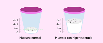 Qué es la hiperespermia?