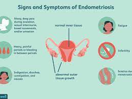 Therapies used to treat endometriosis include: 11 Natural Treatments For Endometriosis
